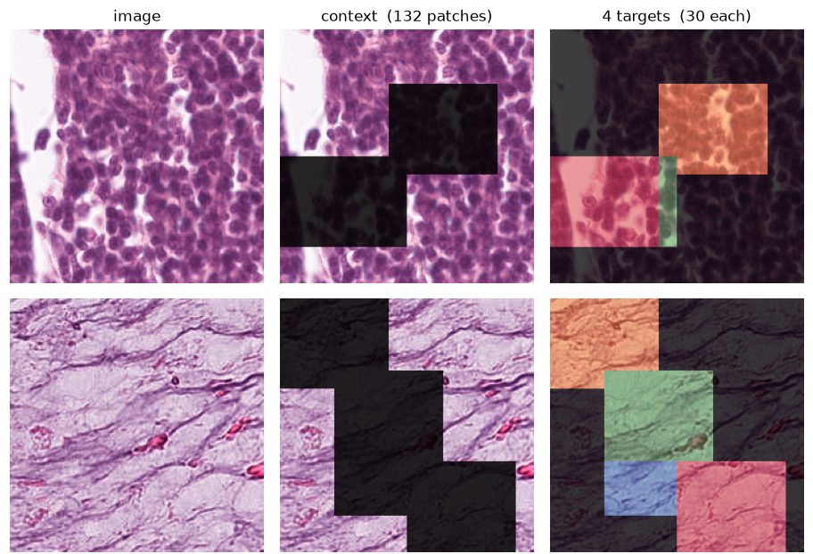 I-JEPA on histology images